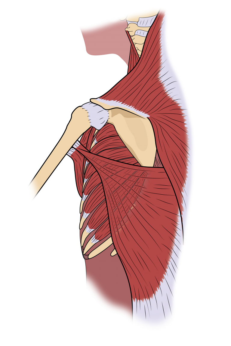 Shoulder Rehab after Breast Cancer de Souza Institute